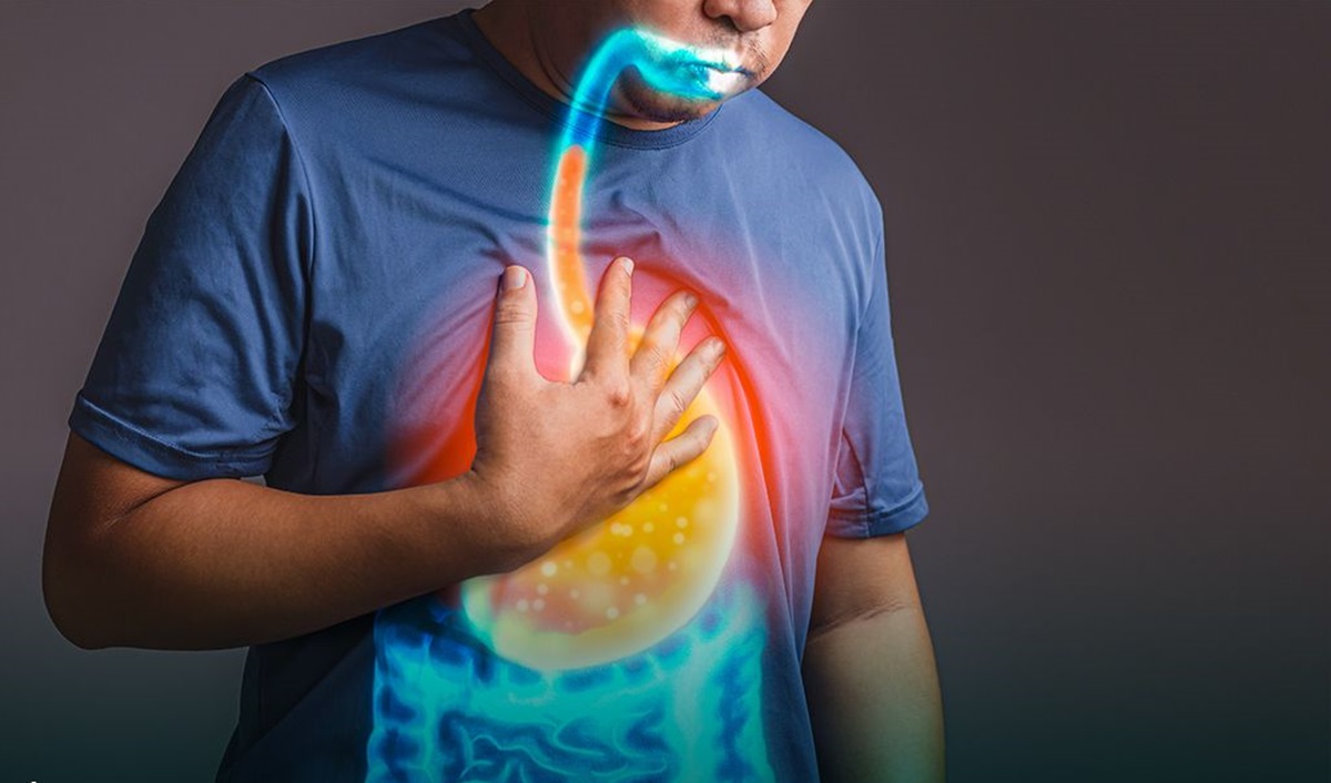 GERD: Kenali Gejala, Pemicu, dan Peran Endoskopi dalam Diagnosis