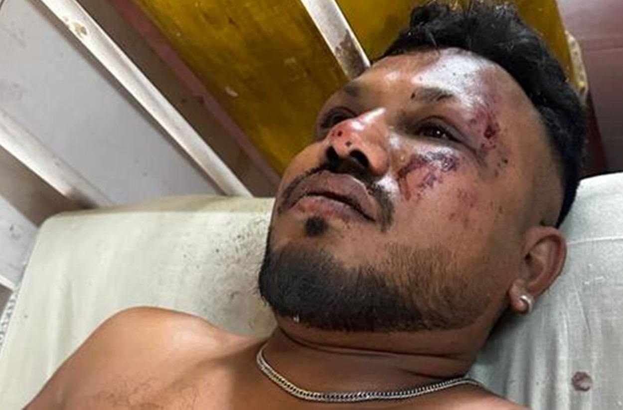Selamat dari Neraka: Kisah Vishwash Korban yang Lolos dari Tragedi Air India FI171