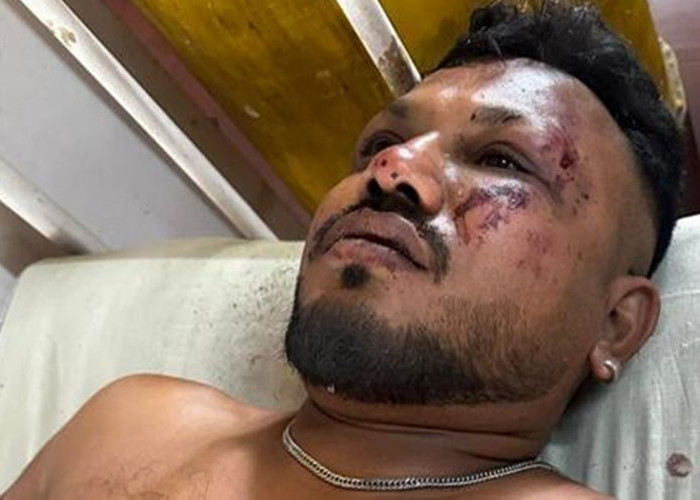 Selamat dari Neraka: Kisah Vishwash Korban yang Lolos dari Tragedi Air India FI171